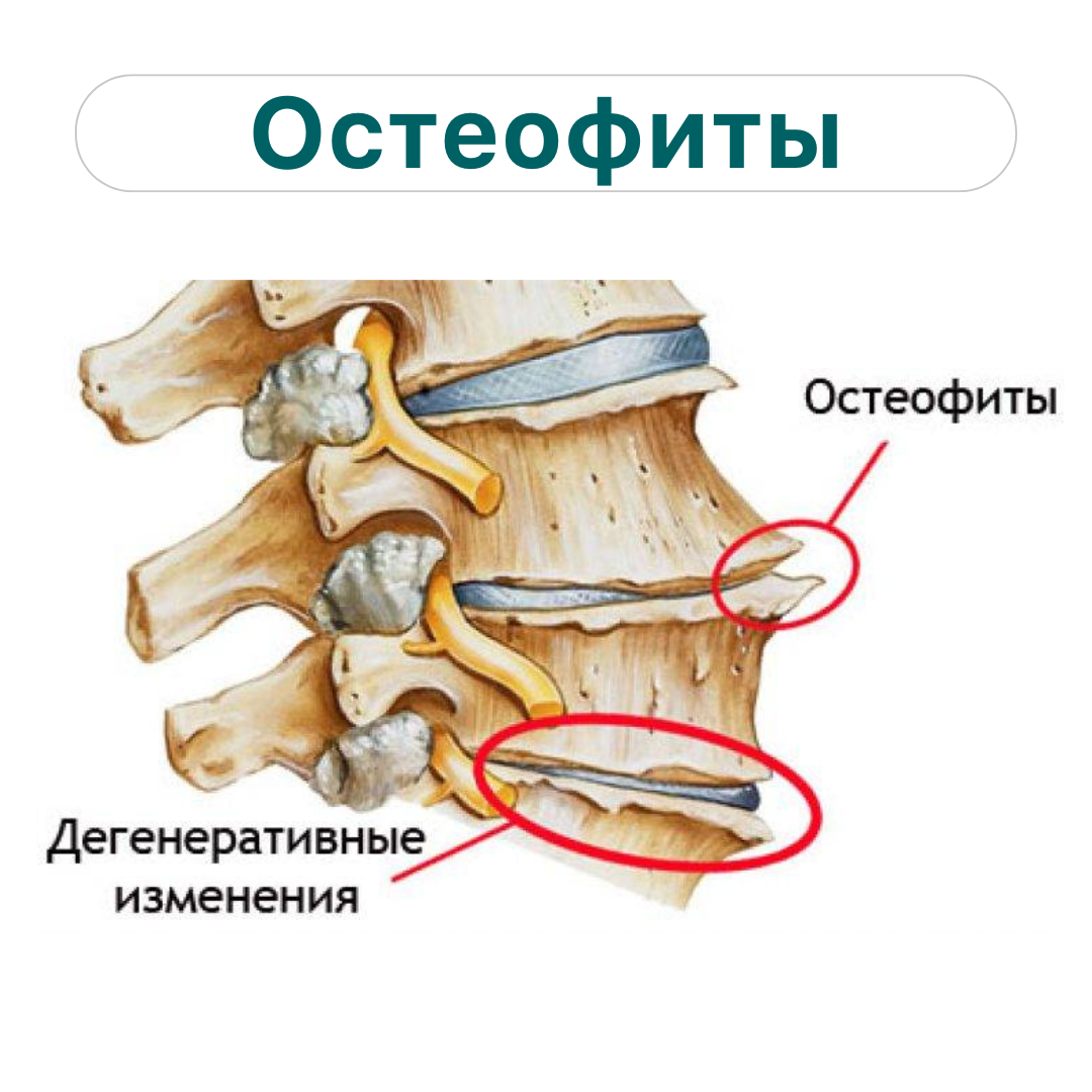 Диагностика профилактика лечение заболеваний позвоночника и суставов